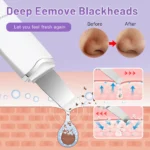 Electric Ultrasonic Skin Scrubber Vibration Face Spatula Peeling Blackhead Remover Facial Lifting Cleansing Ultrasonic Skin Care - Image 4