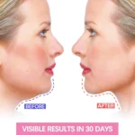 Slimming Facial V-Face Band Infrared Cheek Lifting Face Women Reduce Double Chin Skin Facial Massager Skin Care - Image 4
