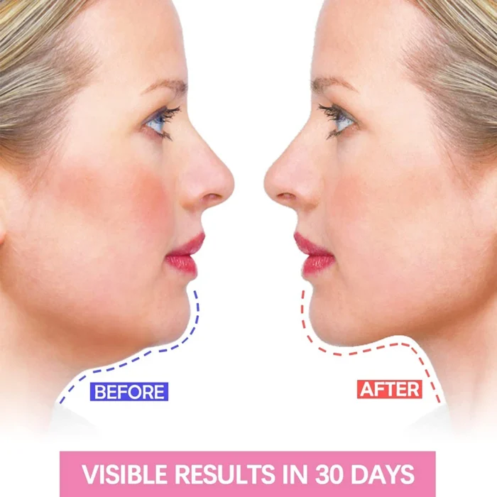 Slimming Facial V-Face Band Infrared Cheek Lifting Face Women Reduce Double Chin Skin Facial Massager Skin Care - Image 4