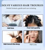 hair growth Serum Anti hair loss For seborrheic alopecia hereditary middle-aged Nourish Shiny Healthy hair Care essential oil - Image 3